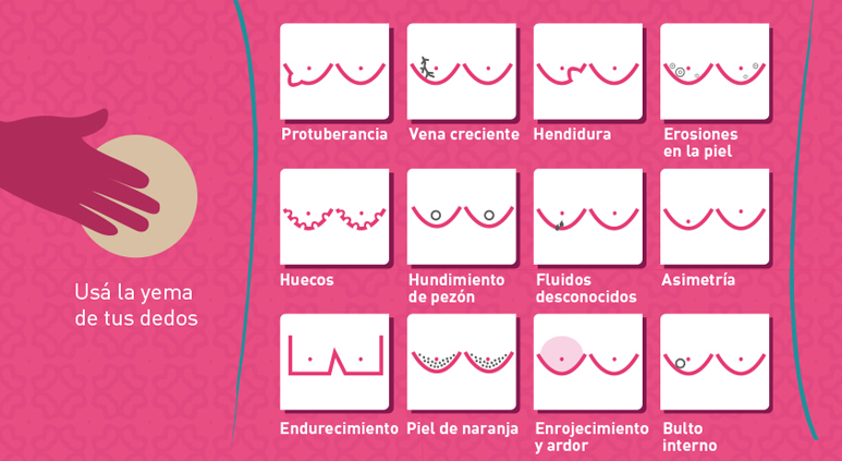 Signos del cáncer de mama a tener en cuenta